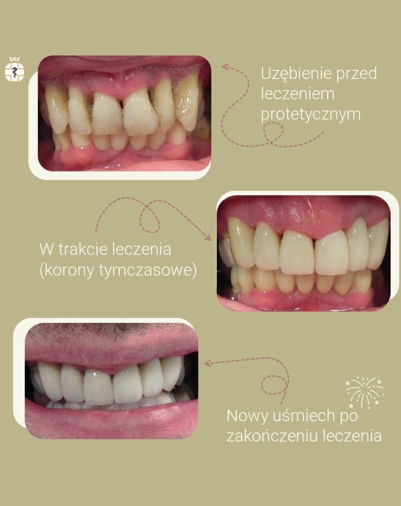 Piękny uśmiech – periodontologia